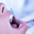 Vaccine to treat gum disease on the way thumbnail