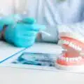 oral facts and tips – gum disease thumbnail