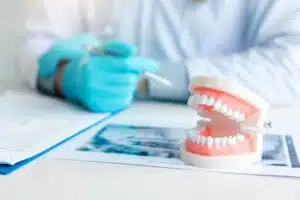 oral facts and tips gum disease