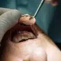 can a dentist tell if you vape How to refill alfakher crown bar main image 0