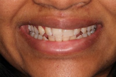 Cosmetic Dentist London After