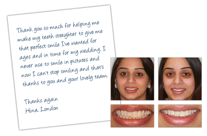 Inman Aligners Testimonial