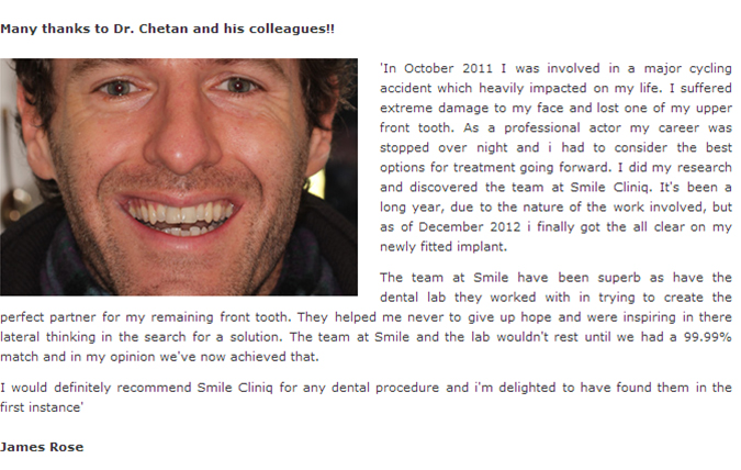 Dental Implants Testimonial