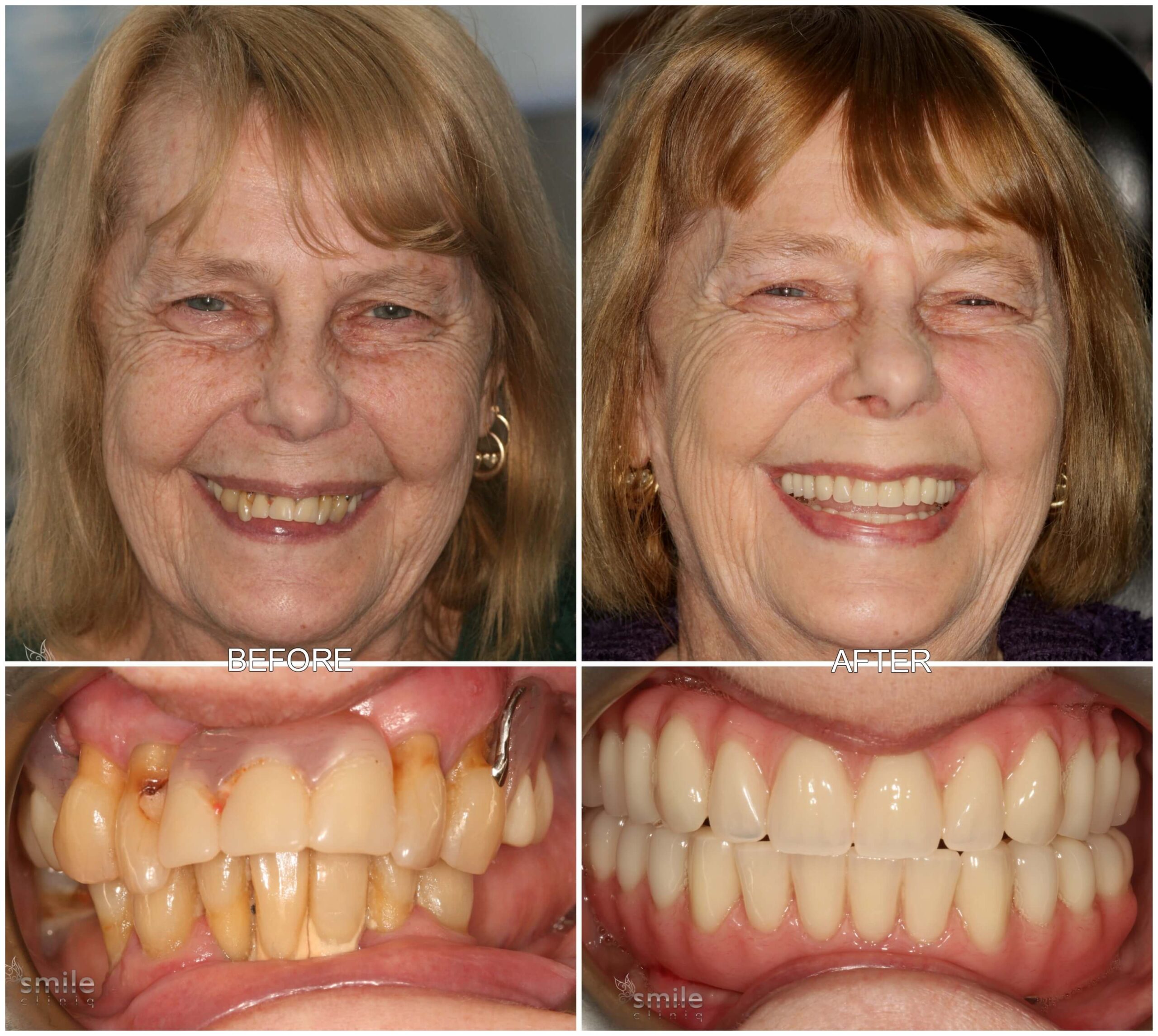 Before and after treatment