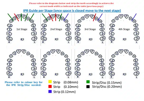 Invisible Braces And Clear Aligners In London | Smile Cliniq