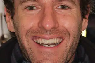 dental implant after