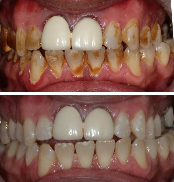 why dental hygiene is important Why is dental hygiene important prevention is better than cure and following a daily hygiene routine will ensure that you have healthy teeth and gums. why dental hygiene is important Why is dental hygiene important prevention is better than cure and following a daily hygiene routine will ensure that you have healthy teeth and gums.