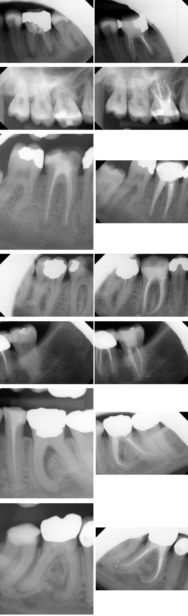 endodontist1