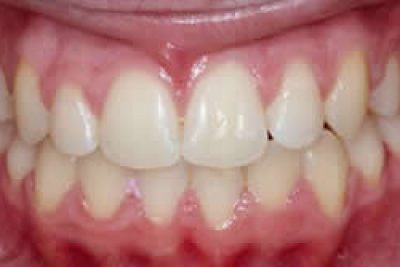 After Specialist orthodontic procedure