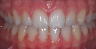 Orthodontics After