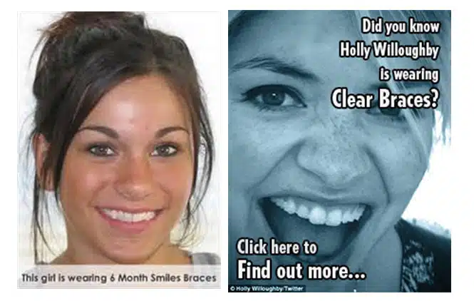 wearing 6-month smiles
