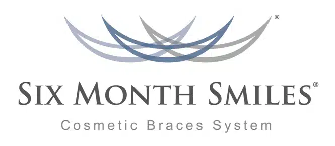 Six Month Smiles Cosmetic Braces System