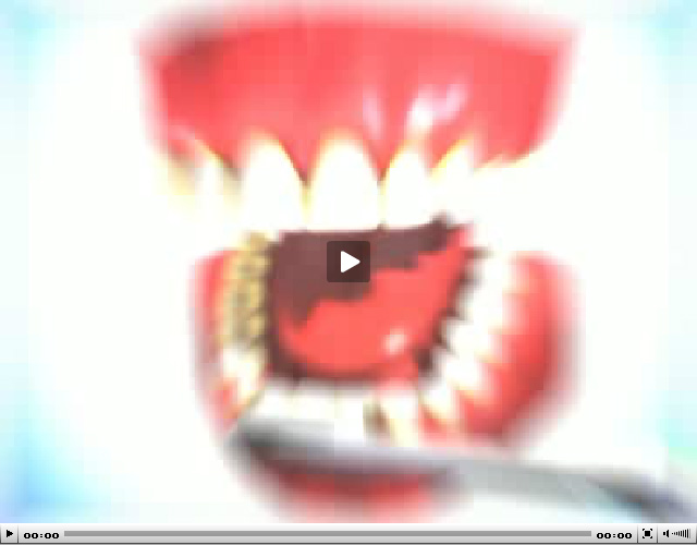 gum1