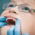 the importance of wearing an orthodontic retainer! thumbnail