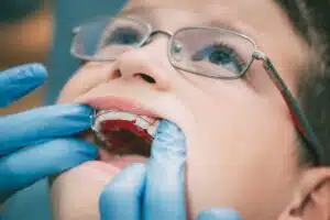 the importance of wearing an orthodontic retainer