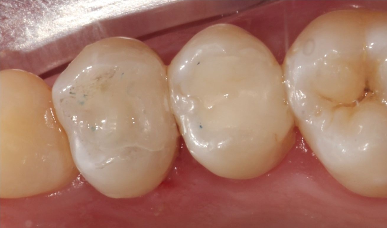 White filling store cost