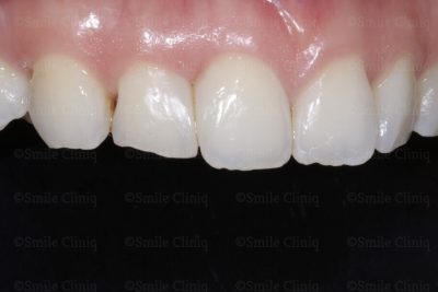 large black triangle after