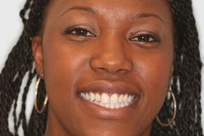 After Invisalign st john's wood dentist