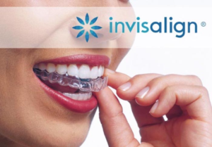 Invisalign