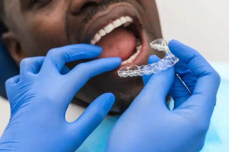 will invisalign work for me