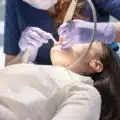 should i replace my amalgam fillings? thumbnail