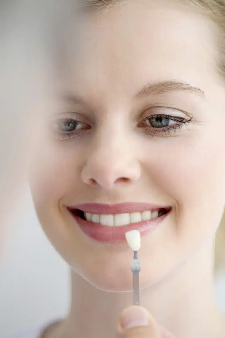 Porcelain Veneers