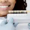 is teeth whitening safe for me? thumbnail