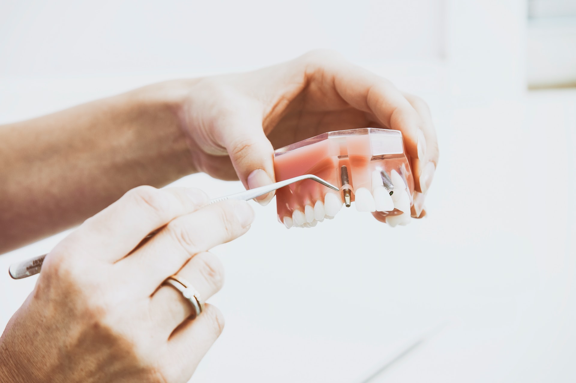 treatment for receding gums
