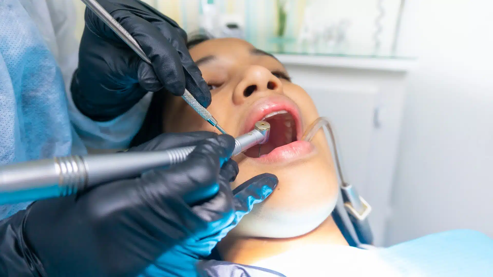 How do you treat tooth decay in children? thumbnail