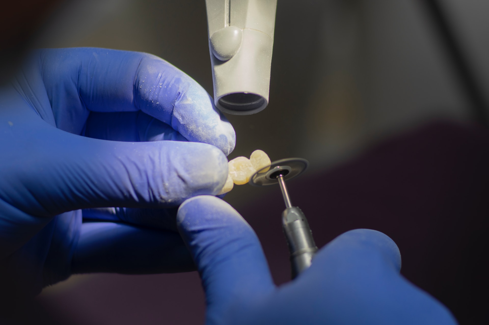teeth implants
