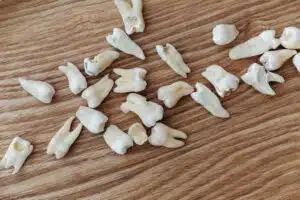 loose teeth on a wooden table