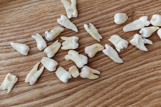 loose teeth on a wooden table
