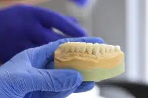 example of human teeth