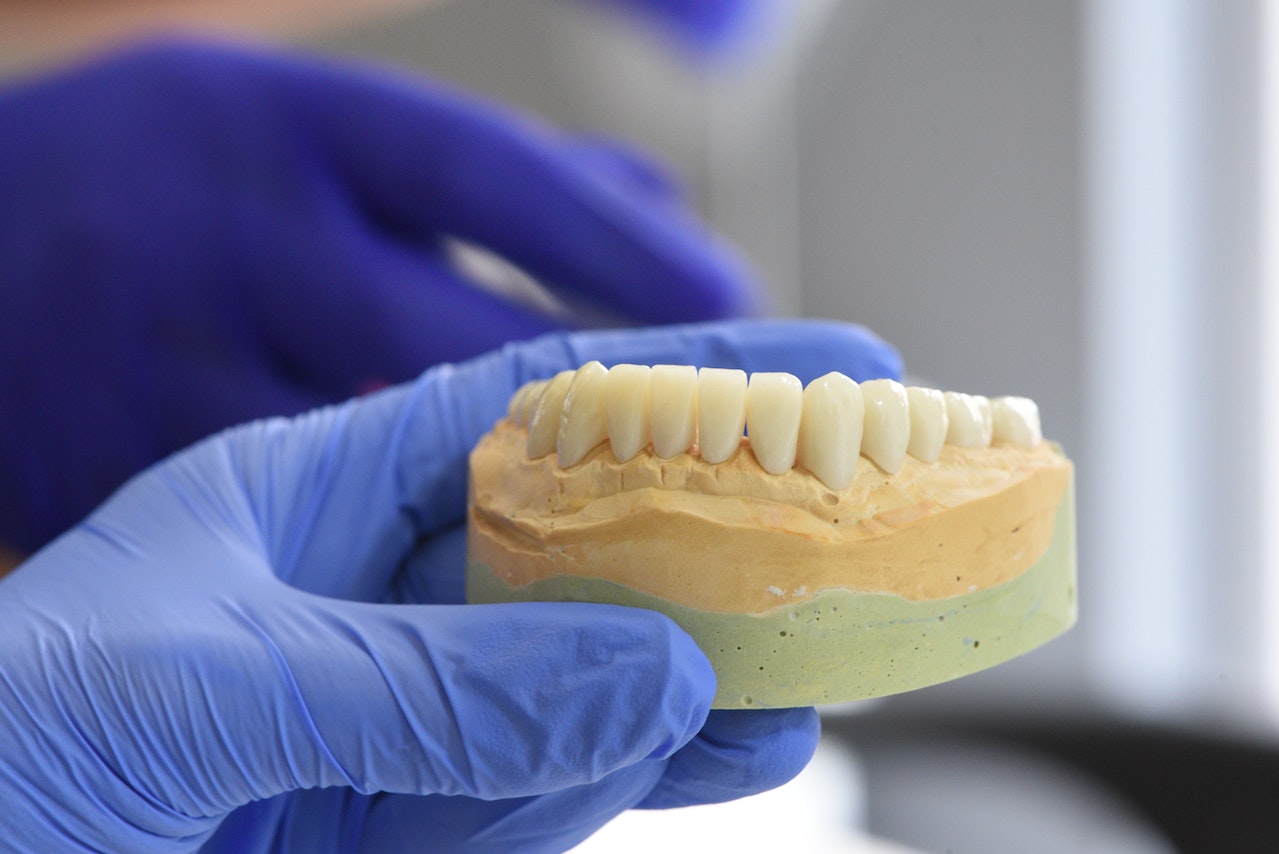 example of human teeth