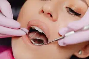 a woman during a dental cleaning procedure