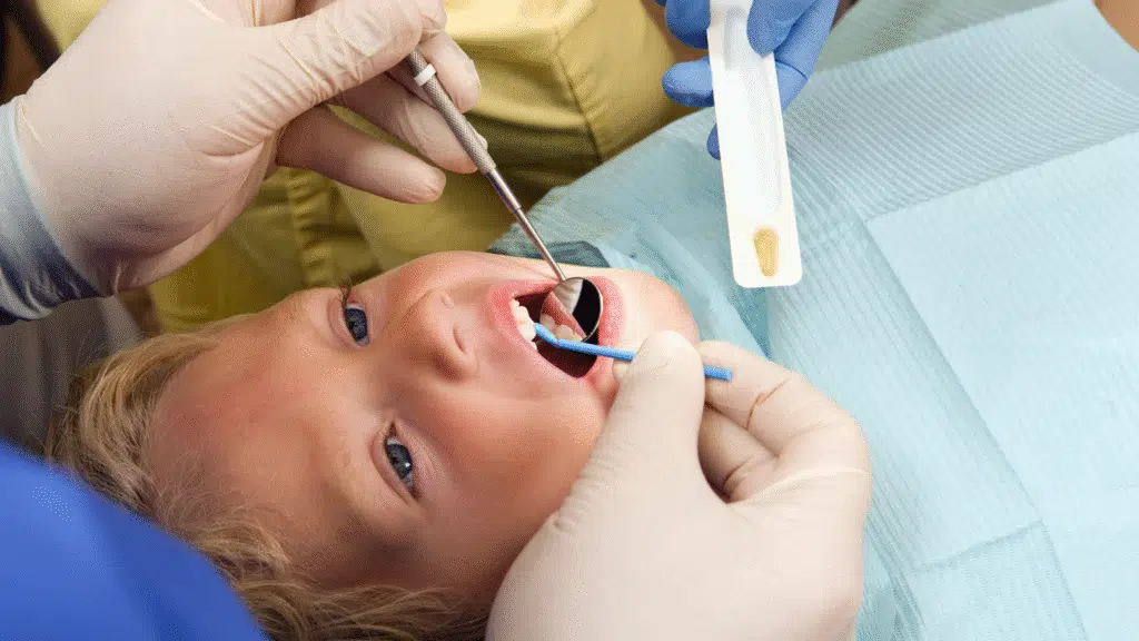 Fluoride varnish for kids at Smile Cliniq