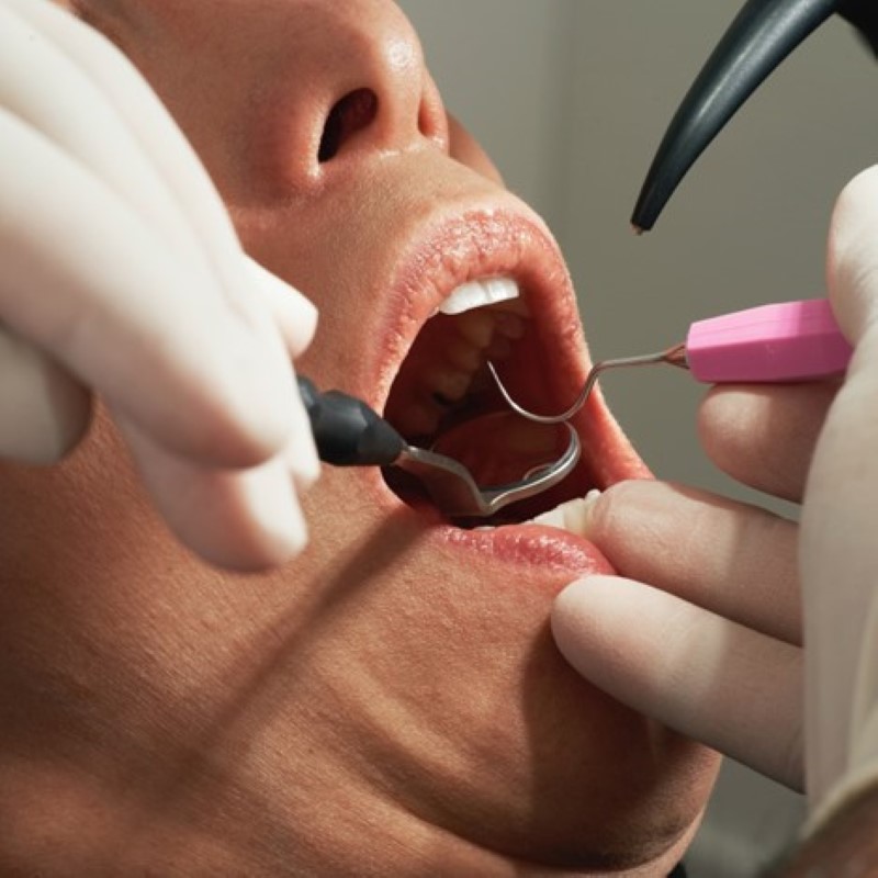 a dentist examining a patient's teeth