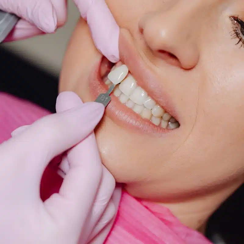 Stages of a Loose Tooth in Adults thumbnail