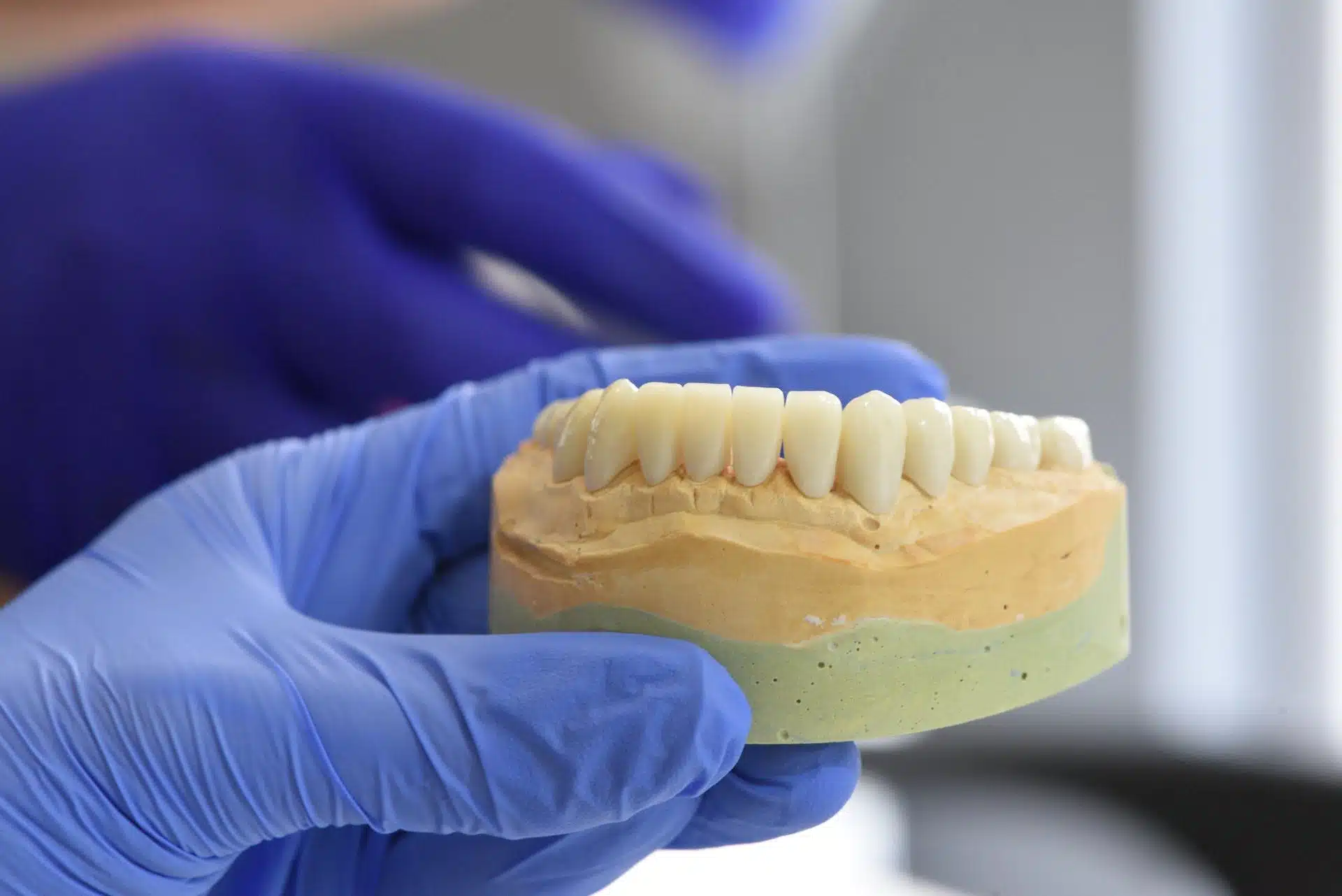 a hand with gloves holding a fake jaw with set of teeth