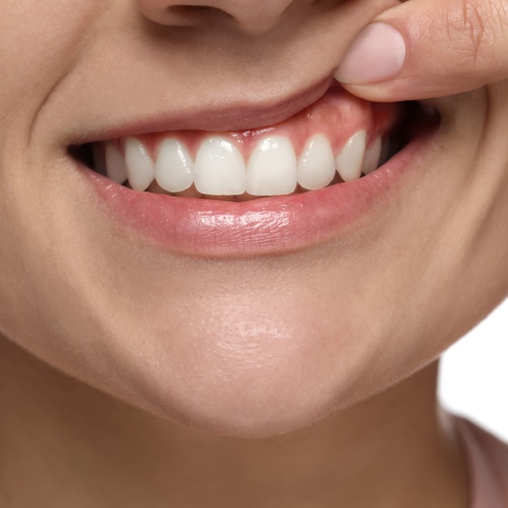 woman showing her teeth and gums