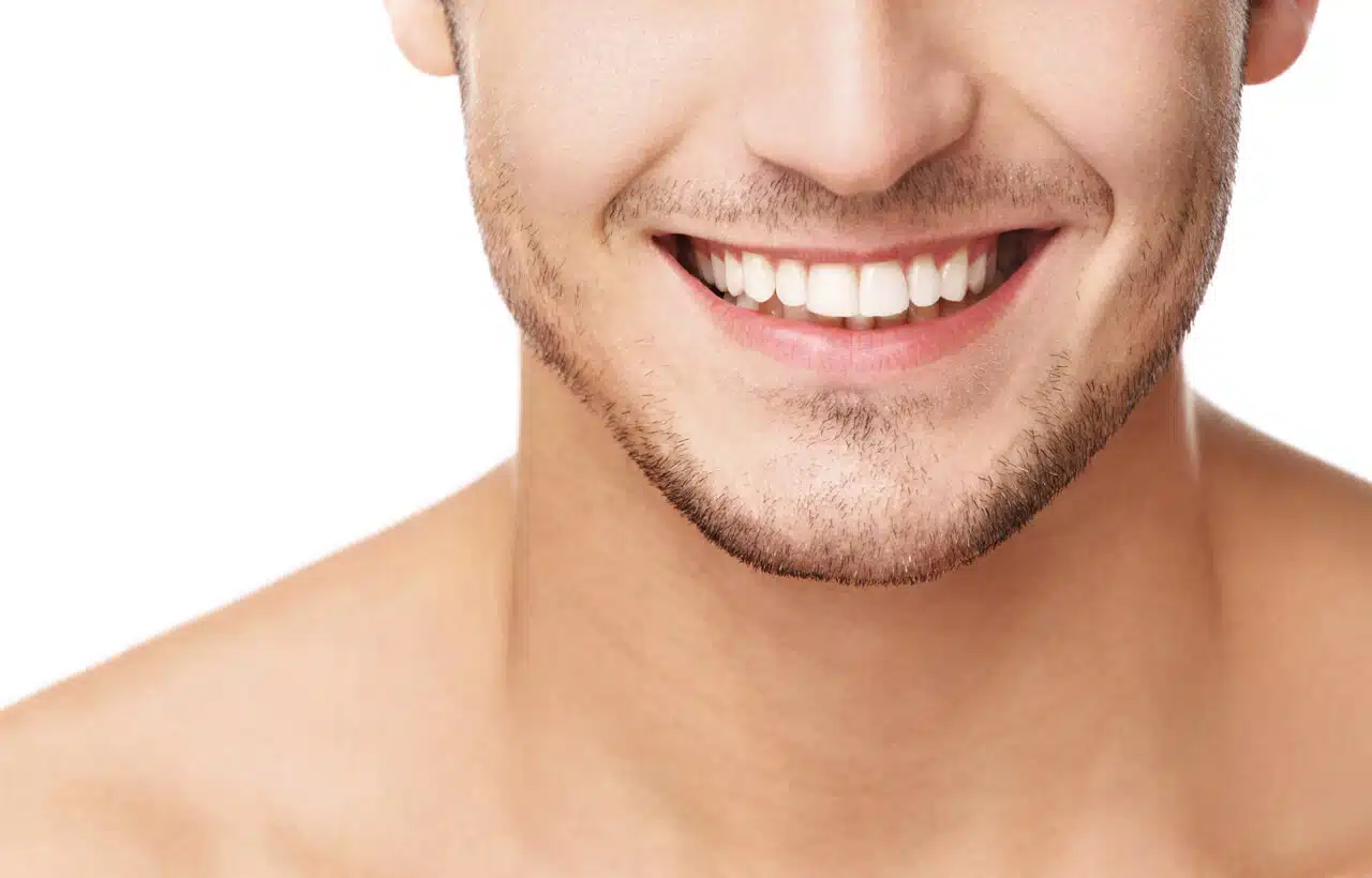 how to get white teeth naturally? thumbnail