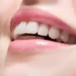 a woman smiling with white teeth