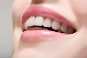 a woman smiling with white teeth