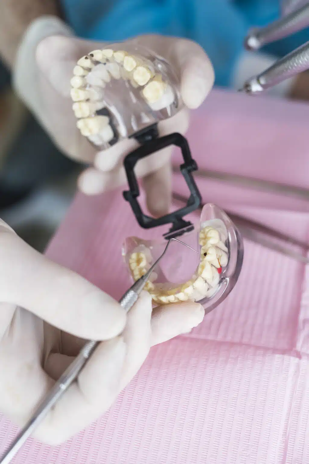 Damon Braces Cost