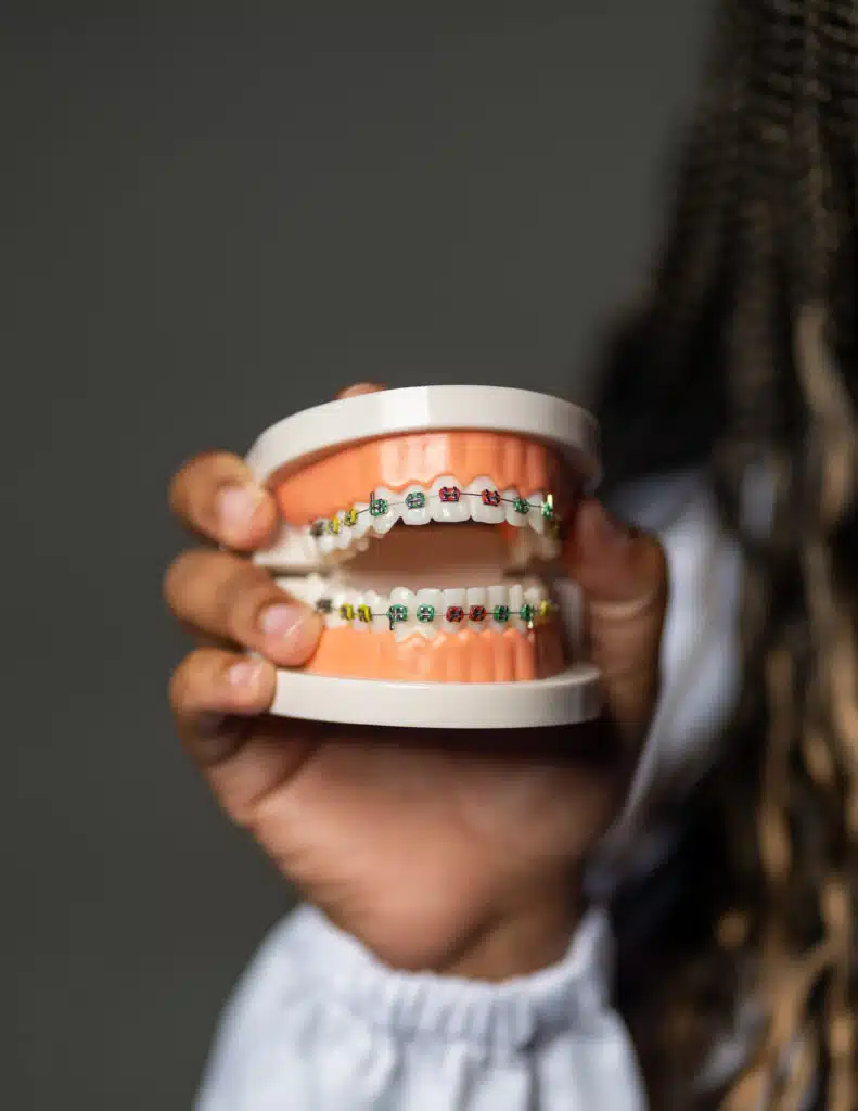 Damon Braces London