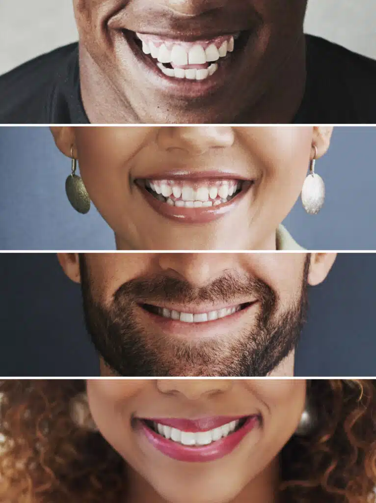 What happens at the end of my six months smile treatment