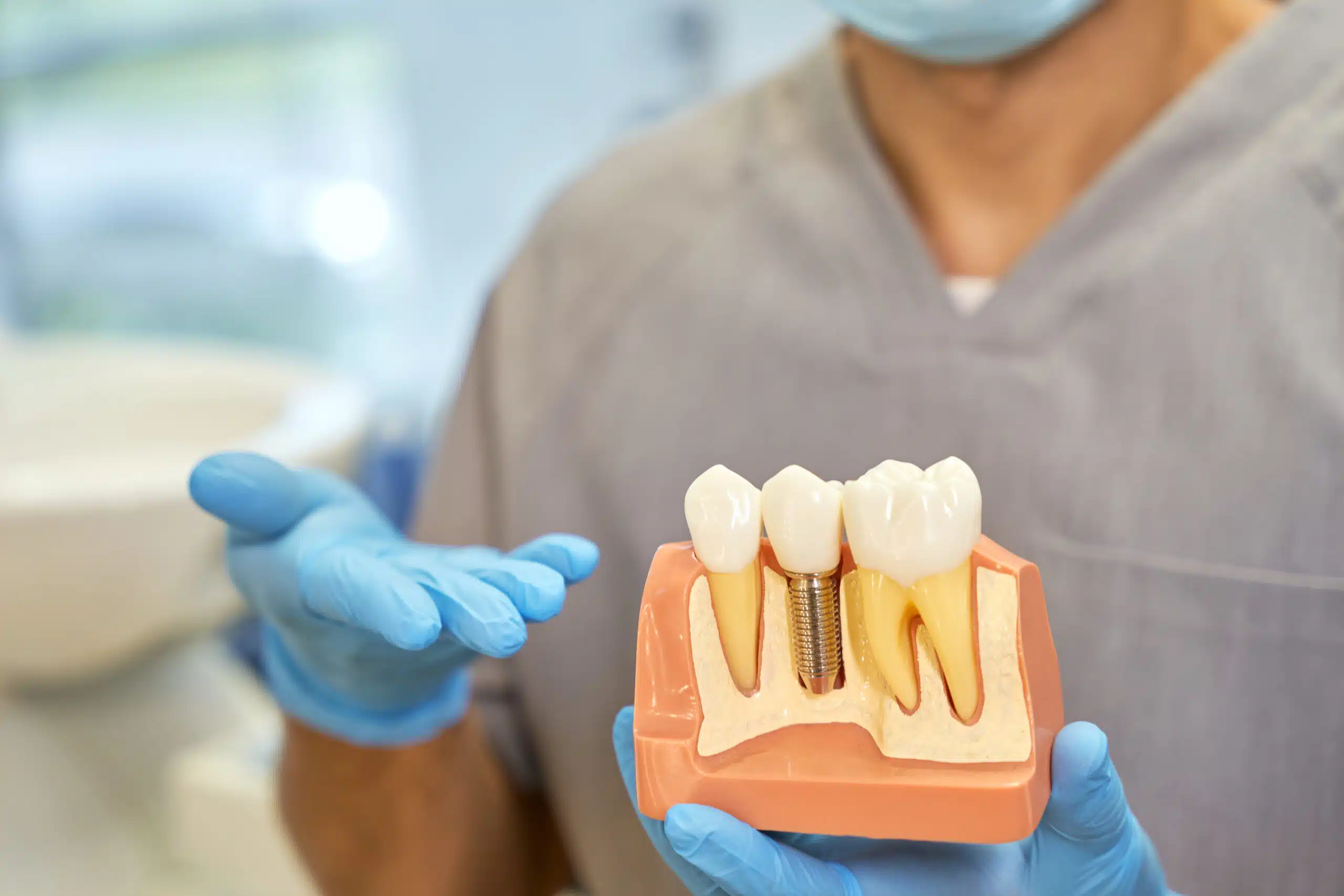 jaw bone dental implants london