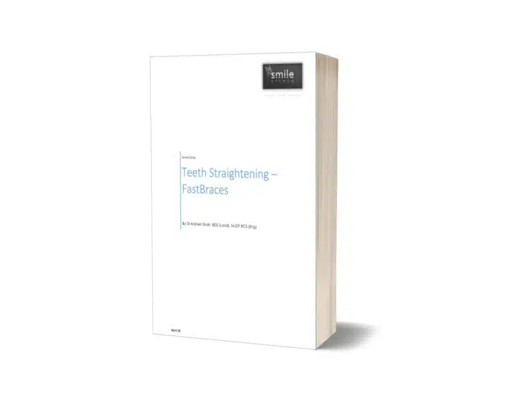 Teeth Straightening – Fastbraces®