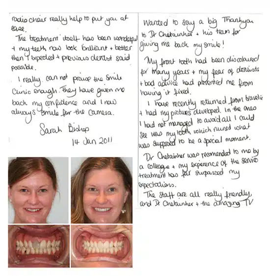 close-up of teeth, before and after cosmetic treatment for a brighter, aligned smile.