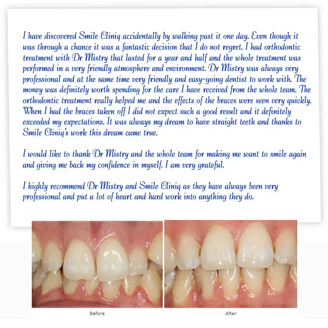 patient's teeth before and after successful orthodontic treatment, with supporting testimonial.